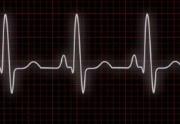 Sudden death in Iskele!